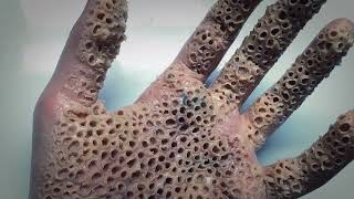 Trypophobia Test  Do you have a fear of small holes [upl. by Isabella]