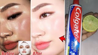 Baking Soda Lemon and Colgate for Face Whitening  Skin Whitening Remedy  Skin Care [upl. by Ttreve]