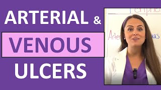 Arterial Ulcers vs Venous Ulcers Nursing Characteristics for PVD Peripheral Vascular Disease [upl. by Gottuard174]