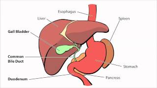 Biliary Atresia  What is Biliary Atresia [upl. by Yelra]