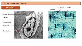 Tecido Ósseo Aula 1 [upl. by Neelear]