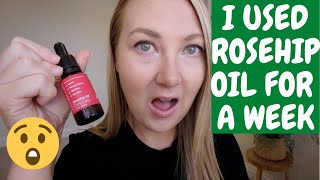 Adding ROSEHIP OIL TO YOUR SKIN CARE ROUTINE You Wont Believe the Results [upl. by Territus213]