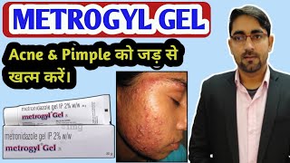 Metrogyl Gel for Acne के बारे में पूरी जानकारी। Metrogyl gel Review  Metrogyl gel Uses in Hindi [upl. by Isaacson]