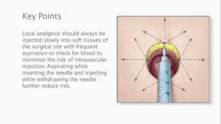 Key Points  Local Analgesic Infiltration for Abdominal Surgery [upl. by Prager]