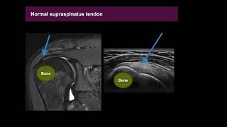 Musculoskeletal MSK Ultrasound Basics [upl. by Martina]