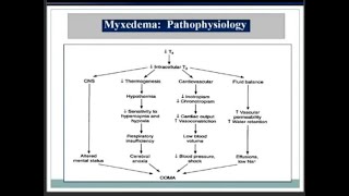 MYXEDEMA CRISIS  ENDOCRINE EMERGENCY  HASHIMATOquotS ENCEPHALOPATHY [upl. by Ylebmik]