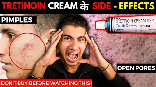 How to Apply Tretinoin Cream I Tretinoin Journey I Tretinoin Side Effects [upl. by Christiane]