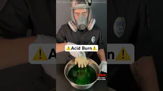 दुनिया का सबसे ताकतवर तेजाब  Worlds Strongest Acid By MAX Gyan [upl. by Frederic]