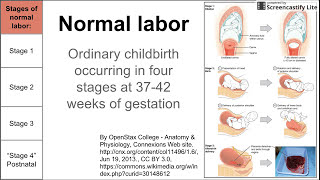 Normal labor ordinary delivery [upl. by Zirtaeb]