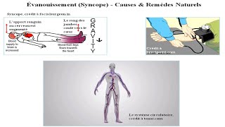 La SyncopeCauses et Remèdes Naturels [upl. by Stuart712]