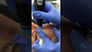 HYDRAFACIAL in slow motion  Dr Medsipa [upl. by Emsmus95]