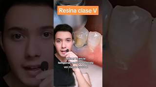 como hacer una resina dental odontologia dentista shorts [upl. by Edvard871]