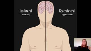 Ipsilateral vs Contralateral [upl. by Nosylla]