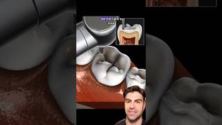 Silver Filling Magic Tooth Transformation [upl. by Nemrac]