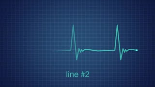 EKG Heart Monitor Flatline After Effects Templates [upl. by Acnaib472]