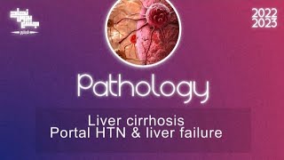 L2 Liver Cirrhosis Portal Hypertension Liver Failure Pathology [upl. by Wallinga]