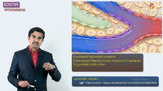 2Edema Pathogenesis  Hemodynamic pathology Fmge amp Neet PG [upl. by Ateekahs]