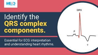 Identifying components of the QRS complex [upl. by Mulac747]