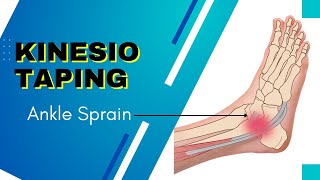 How to Apply kinesiology Tape for an Ankle Inversion Sprain [upl. by Millford]