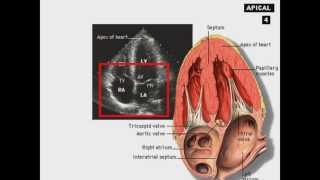 Echocardiography Introduction [upl. by Feucht657]