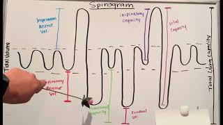 Do You Know the Spirogram [upl. by Pierette247]