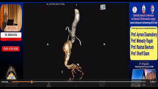 Vascular online training DCGC 2023 Prof Hadya great lecture on EVAR challenging cases [upl. by Norabel]