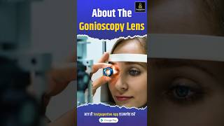 About the gonioscopy lens goniolens glaucoma ophthalmology testpaperlive education [upl. by Leryt]