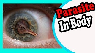 10 Signs And Symptoms Your Body is Full of Parasites [upl. by Annwahsal971]