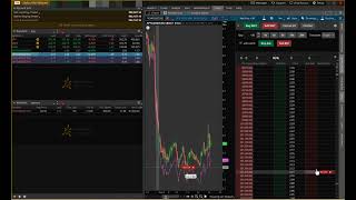 ThinkorSwim Setup For Options Day Trading  Automatic Stop Loss amp Profit Taking [upl. by Marteena879]