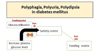 Polyuria Polyphagia Polydipsia in Diabetes mellitus [upl. by Kelwunn]