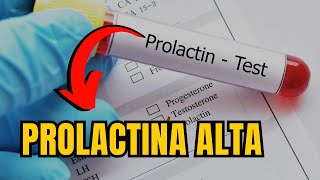 PROLACTINA ALTA QUAIS OS SINTOMAS QUAIS AS CAUSAS COMO TRATAR [upl. by Sregor]