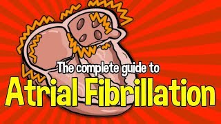 Complete Guide To Atrial Fibrillation Causes symptoms and treatments [upl. by Illene855]