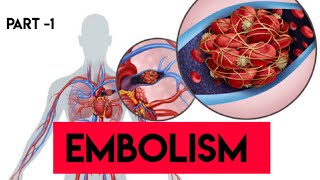 Embolism  Part 1 Pathology  Decompression Sickness  Amniotic Fluid Embolism  Harsh Mohan [upl. by Marchall]