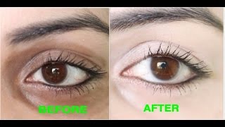 How to Remove Dark Circles Naturally in 3 Days 100 Results [upl. by Frederico]