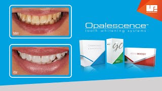 Professional Results with Opalescence™ teeth whitening [upl. by Japeth]