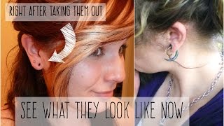 WHY I TOOK MY EAR GAUGES OUT [upl. by Tnarb77]