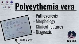 Polycythemia vera  Myeloproliferative Disorders  Pathology [upl. by Katherin]