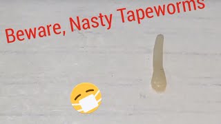 REAL MOVING TAPEWORM informative Video [upl. by Angie997]