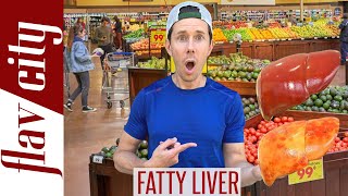 Top 10 Foods For Reversing FATTY LIVER DISEASEAnd What To Avoid [upl. by Andrej]