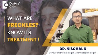 What are Freckles amp How to get rid of it using Lasers  freckles  Dr Nischal K  Doctors Circle [upl. by Eniger366]