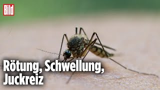 InsektenstichAlarm So schützen Sie sich richtig [upl. by Ayouqes]