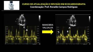 DIRETRIZ ASEEACI 2016  ESTUDO DA FUNÇÃO DIASTÓLICA DO VENTRÍCULO ESQUERDO [upl. by Farland586]