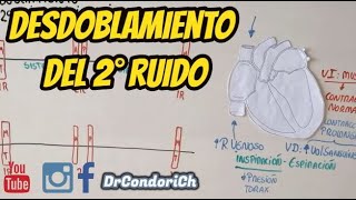 Desdoblamiento Fisiologico del 2do Ruido cardiaco ¿que es el desdoblamiento Facil y sencillo [upl. by Adiehsar]