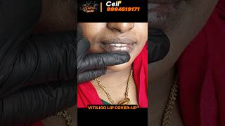 Vitiligo lips vitiligo treatment in trichy best method vitiligo treatment best tattoo studio [upl. by Yroffej]