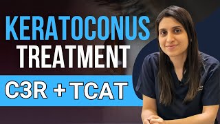 Treatment Of Keratoconus C3R TCAT C3R [upl. by Vona204]