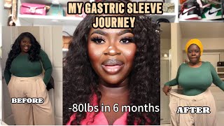 MY GASTRIC SLEEVE JOURNEY [upl. by Dedra168]