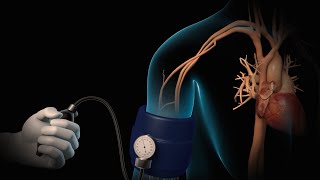 High Blood Pressure  Hypertension  Nucleus Health [upl. by Ellirpa]