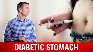 Diabetic Stomach Explained – Dr Berg [upl. by Guinn385]