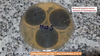 Cladosporium and Penicillium Colony Morphology on SDA and LPCB Preparation [upl. by Nilekcaj342]