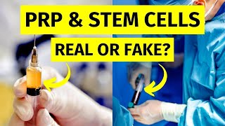 PRP and Stem Cell Therapy for Beginners [upl. by Glinys346]